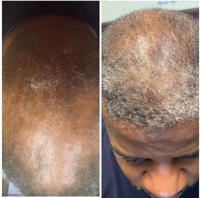 Emmi’s Hair Oil Plus